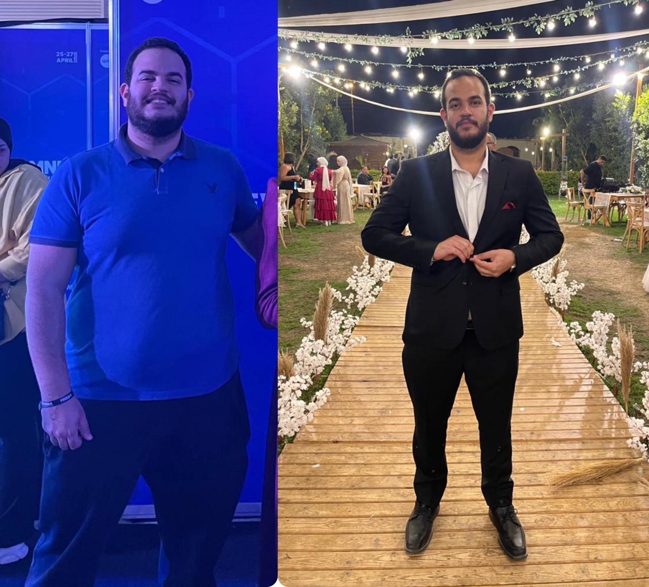 Featured Transformation 14
