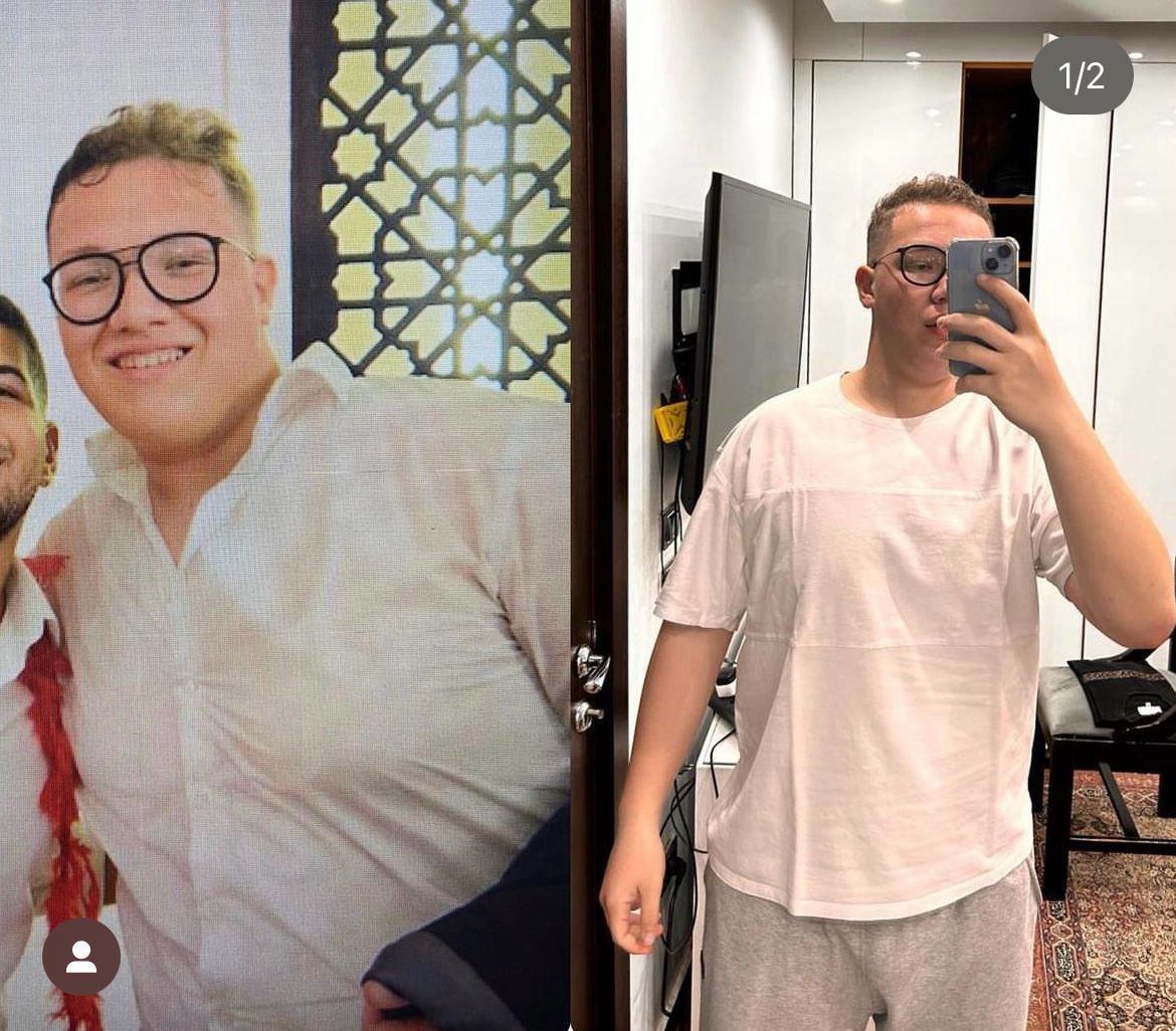 Featured Transformation 21
