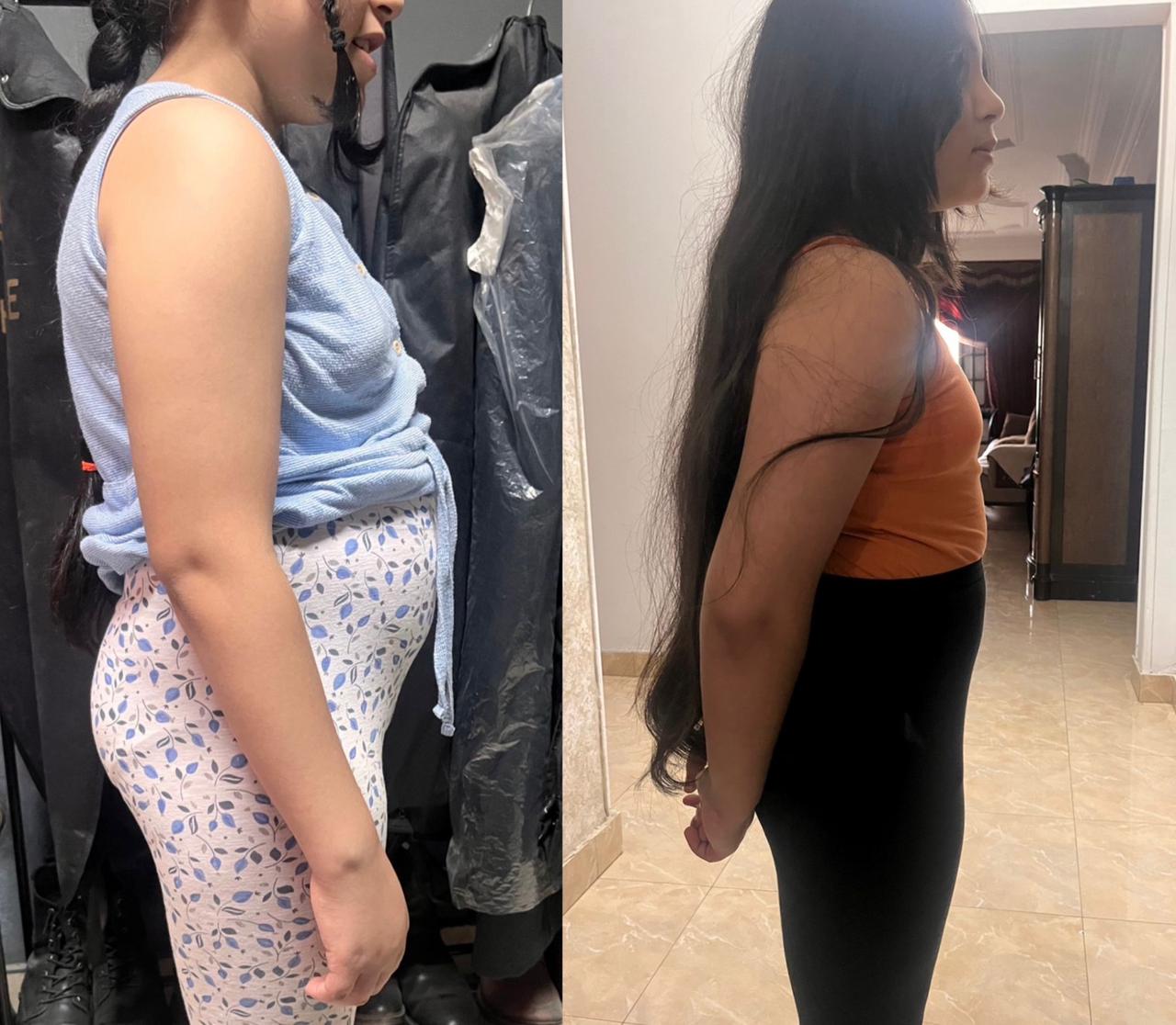 Featured Transformation 7