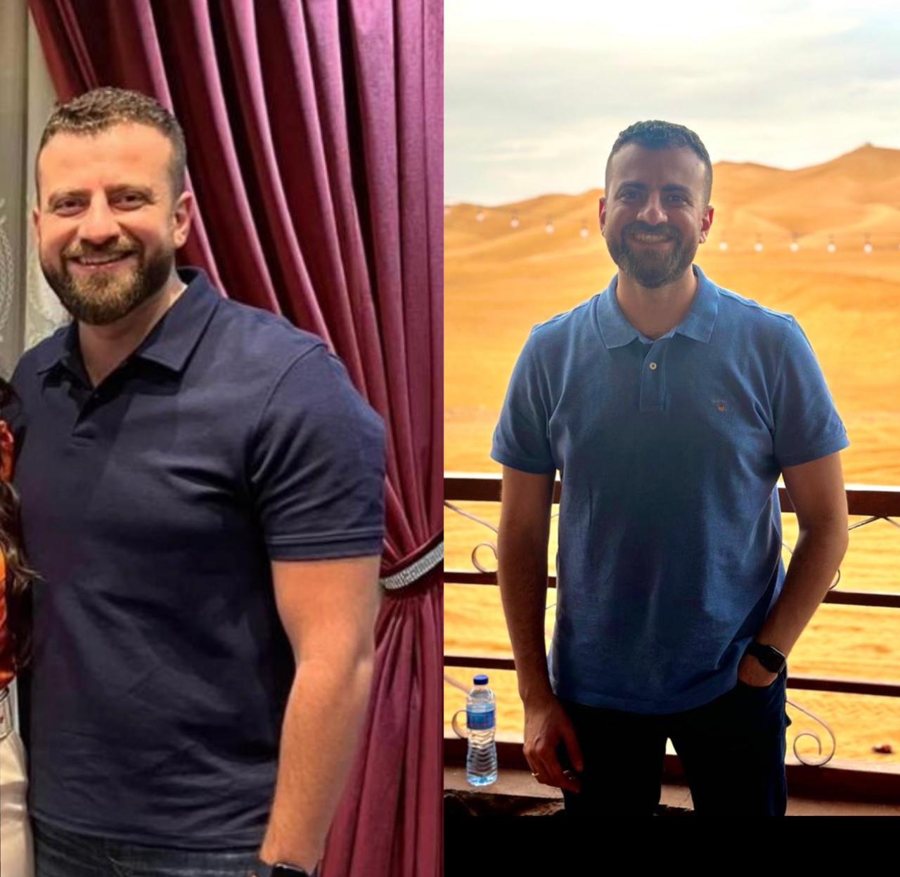Transformation