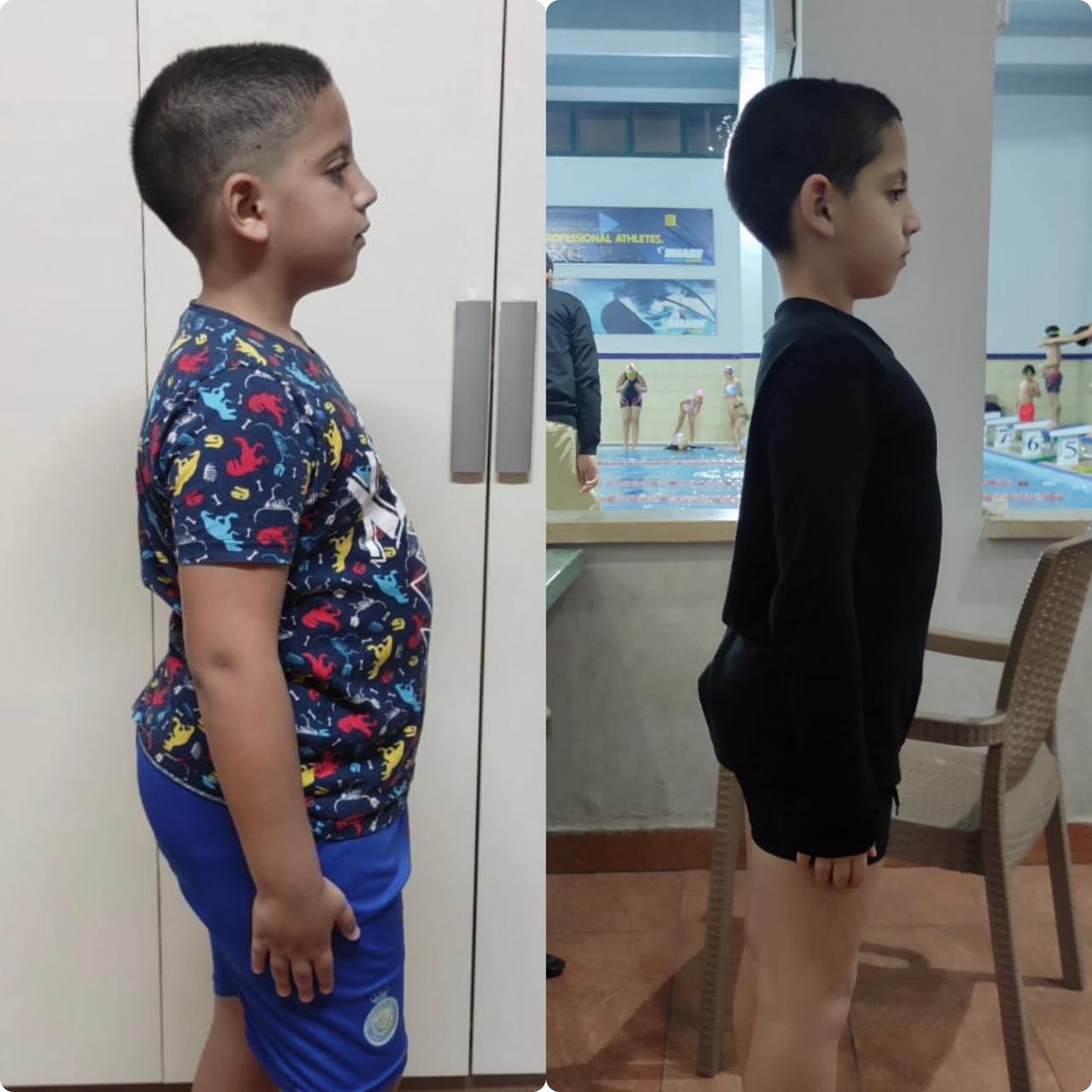 Transformation